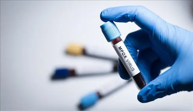 سازمان جهانی بهداشت: ویروس آبله میمونی «ام پاکس» در کشورهای بیشتری شناسایی شده است