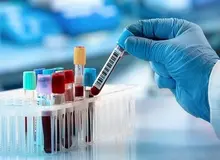 دستاوردی به رهبری دانشمند ایرانی در استرالیا: ساخت دستگاهی که تشخیص زودهنگام سرطان از روی خون را ممکن می‌کند