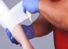 هزینه‌های بالای مراکز درمان سوختگی