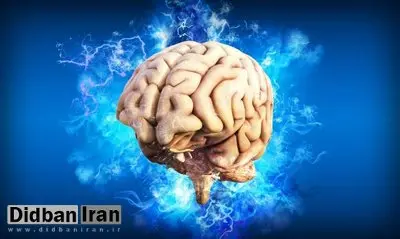 شکل مغز شما رفتار شما را تعیین میکند؟