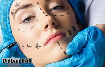 با سونامی عمل‌های زیبایی مواجهیم/ افزایش ۴۰ درصدی آمار جراحی زیبایی در دنیا