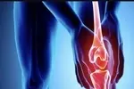 پرتودرمانی، درد شایع‌ترین نوع آرتروز را کاهش می‌دهد