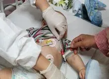  
رییس بخش عفونی بیمارستان کودکان مفید: بیمارستان‌های اطفال از بیماران کرونایی پُر شد