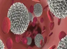 شناسایی زودهنگام لوسمی با آزمایشی پیشرفته