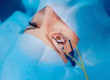 دبیر علمی کنگره چشم‌پزشکی ایران: ازدواج فامیلی سبب افزایش بیماری‌های ارثی شده