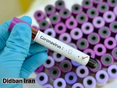 درگذشت دو برادر هنرمند به دلیل ابتلا به کرونا