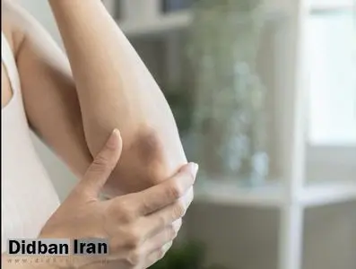 هموفیلی B؛ اختلال نادری که شاید پشت کبودیهای شما پنهان شده باشد