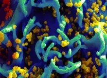 کشف ۷ عامل سرطانزای جدید از سوی دانشمندان