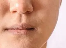 علائم جدی کمبود ویتامین A در بدن