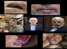 پلیس اسرائیل: پیکر متعلق به سنوار است و هویت او از طریق بررسی دندان‌ها شناسایی شد