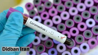 آزمایش موفقیتآمیز واکسن جدید کرونا توسط دانشگاه بریستول انگلیس
