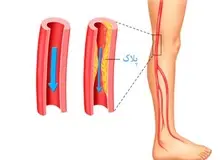 تغییراتی برای بهبود گردش خون در پاها