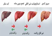 علائم و نشانه‌های ظاهری و بالینی بیماری کبد چرب را بشناسید