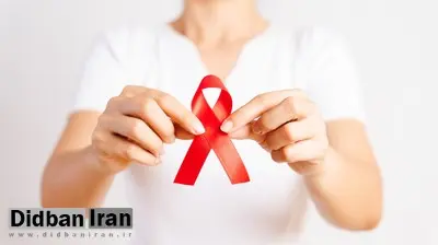 زنان مبتلا به ایدز بیشتر در معرض تسریع علائم پیری هستند