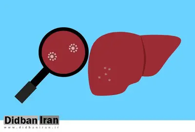 ۱.۵ میلیون مرگ ناشی از سرطان کبد تا ۲۰۵۰