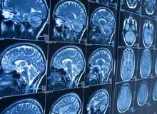 هوای گرم عملکرد مناسب مغز انسان را مختل می‌کند