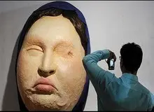 صدور حکم دیه در پرونده اسیدپاشی اصفهان
