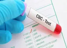 شناسایی یک گروه خونی نادر در کرمان