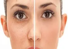 عادت‌های اشتباهی که باعث مسدود شدن منافذ پوست می‌شود