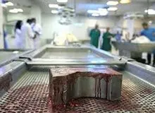 تایید، تکذیب، کتمان/ عضو کمیسیون بهداشت : در جلسه  فردای کمیسیون مسئله فروش «جسد توسط مافیا» را مطرح می کنیم / رئیس سازمان پزشکی قانونی: جسد فروشی نداریم 