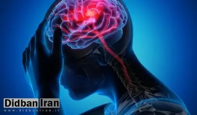 وضعیتی که باعث کوچک شدن مغز انسان میشود
