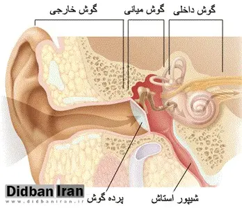 پارگی پرده گوش درمان دارد