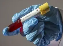 ابتلای سه نفر در استان البرز به بیماری کرونا تایید شد
