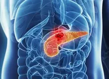 دانستنی هایی از یک التهاب خاص در بدن!