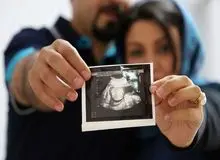 رئیس انجمن ناباروری ایران: ۱۲ تا ۱۵ درصد از زوج‌های ایرانی مشکل ناباروری دارند