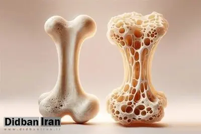 ۷ ویتامین برای تقویت استخوانهای بدن+اسامی