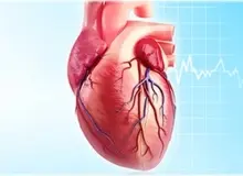 درباره سکته قلبی بیشتر بدانیم