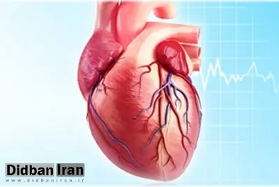 درباره سکته قلبی بیشتر بدانیم