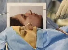 جراحی‌بینی از مد افتاد؛ نوبت چشم‌گربه‌ای و کپی از هنرپیشه‌ها رسید