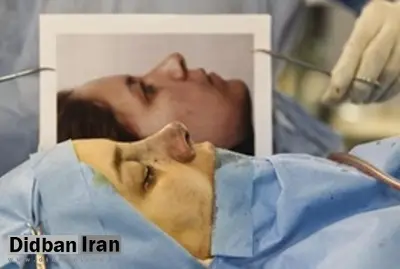 جراحیبینی از مد افتاد؛ نوبت چشمگربهای و کپی از هنرپیشهها رسید