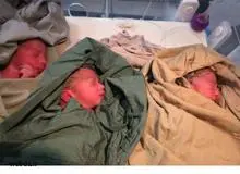 در بیمارستانهای دولتی گروکشی نداریم/ زایمان طبیعی در بیمارستانهای دولتی رایگان است