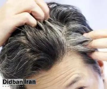 استرس و فشار عصبی باعث سفیدی مو می شود