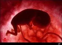 شناسایی و پلمب یک مرکز پزشکی غیرمجاز سقط جنین/ متهم دستگیر شد