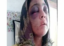 دستگیری  شکنجه گر  ۸۳ ساله  رودباری / شکنجه همسر ۲۸ ساله با سیخ داغ و چوب دستی/ عکس