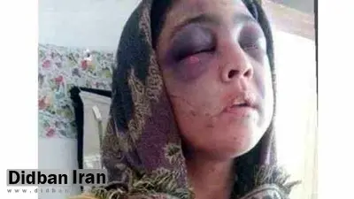 دستگیری شکنجه گر ۸۳ ساله رودباری / شکنجه همسر ۲۸ ساله با سیخ داغ و چوب دستی/ عکس
