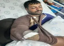 جراحت محیط‌بان اصفهانی با شلیک مستقیم شکارچی غیرمجاز