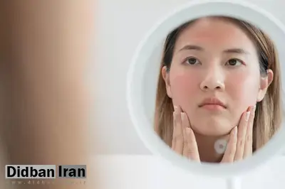 دلایل ایجاد جوش زیرپوستی ؛ روش های درمان پزشکی و خانگی جوش زیرپوستی