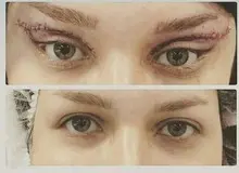 جراحی بینی از مد افتاد، مُد جدید؛ چشم‌گربه‌ای