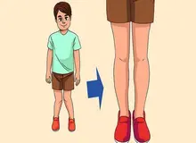  یک ورزش مخصوص برای درمان عارضه زانو ضربدری‌ در کودکان و نوجوانان