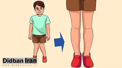  یک ورزش مخصوص برای درمان عارضه زانو ضربدری‌ در کودکان و نوجوانان