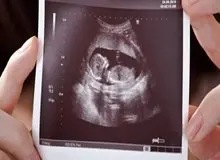 معاون پیشگیری از معلولیت‌های سازمان بهزیستی کشور : طرح جوانی جمعیت یا تولد سالانه ۷۰۰ نوزاد دارای معلولیت/ سقط‌های زیر زمینی افزایش پیدا می‌کند