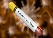 واکسن «کرونا» تا ۴۰ روز دیگر تولید می‌شود 