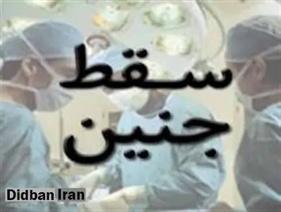 نامه ۱۲۰ پزشک به وزیر بهداشت برای کاهش آمار سقط جنین