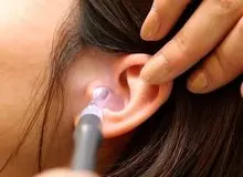 سرطان لاله گوش چیست و چه علائمی دارد؟