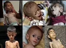 یونیسف: یک میلیون کودک غزه دچار شوک‌های روانی و سوءتغذیه هستند