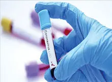 احتمال روند افزایشی کرونا در بهار/ لزوم تزریق دزهای یادآور واکسن کرونا